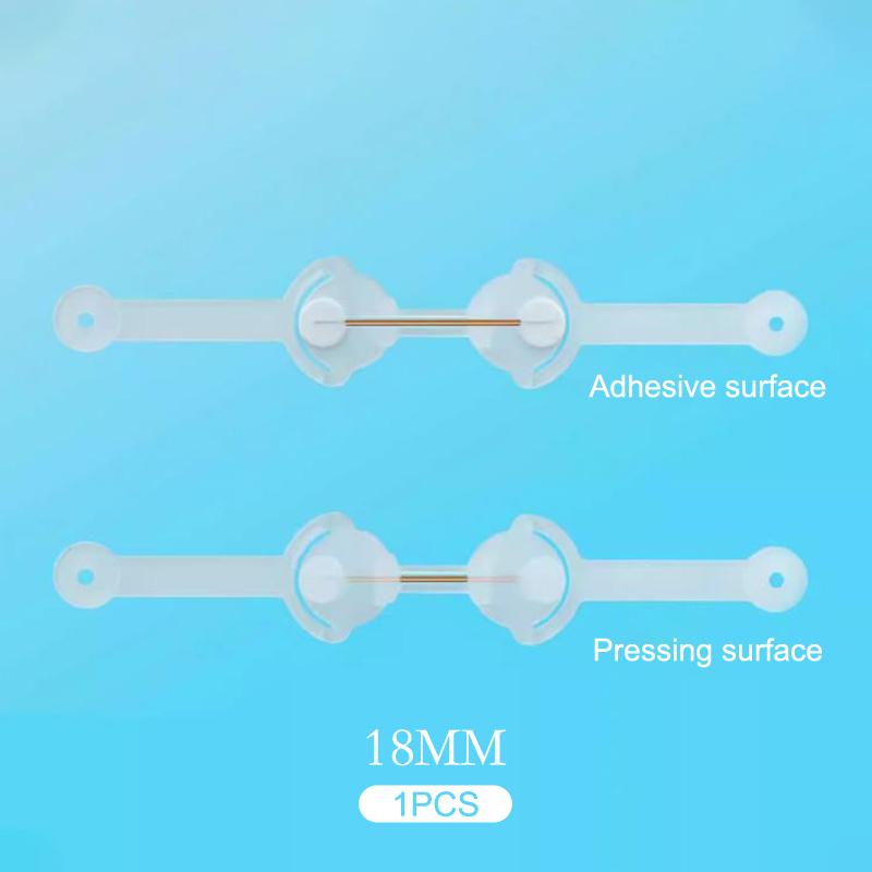 Инструмент для коррекции вросшего ногтя с эластичной наклейкой-пластырем, выпрямляющим зажимом-скобой - Средство для лечения ногтей на ногах, Педикюрное решение