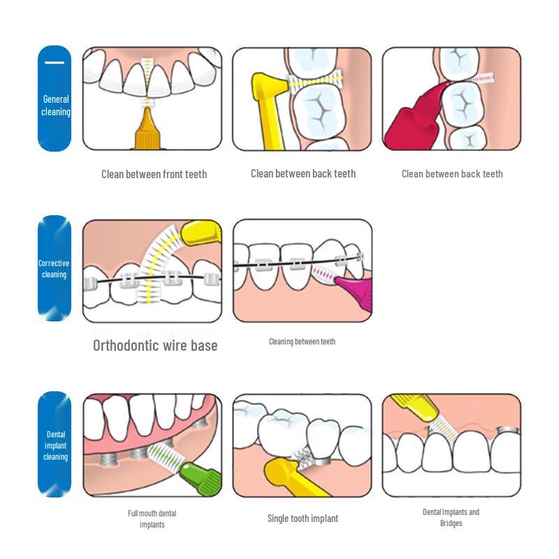 Tepe I-Shaped Interdental Brushes for Orthodontics