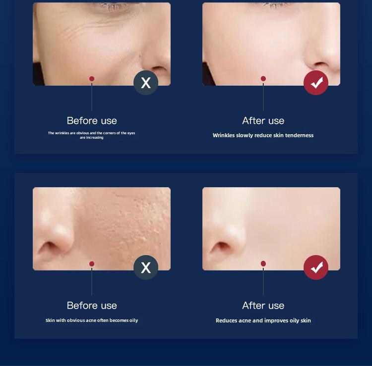 Складной светодиодный спектрометр для омоложения кожи с холодным спреем и красно-синей светотерапией для салонов