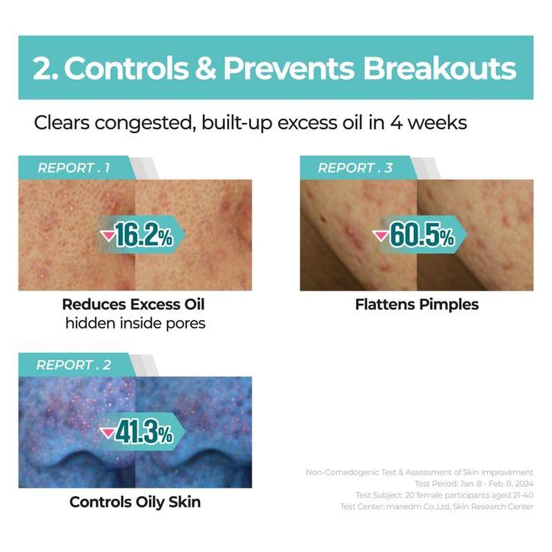 numbuzin - No.1 Pantothenic B5 Active Soothing Cream
