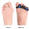 Adjustable Silicone Toe Corrector for Overlapping Valgus
