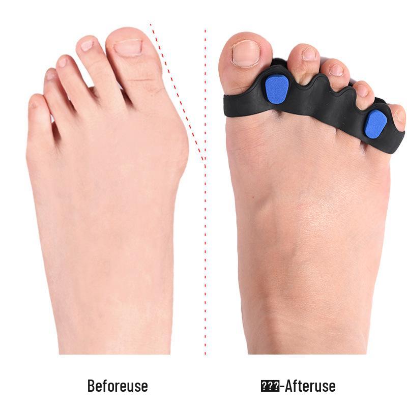 Adjustable Silicone Toe Corrector for Overlapping Valgus