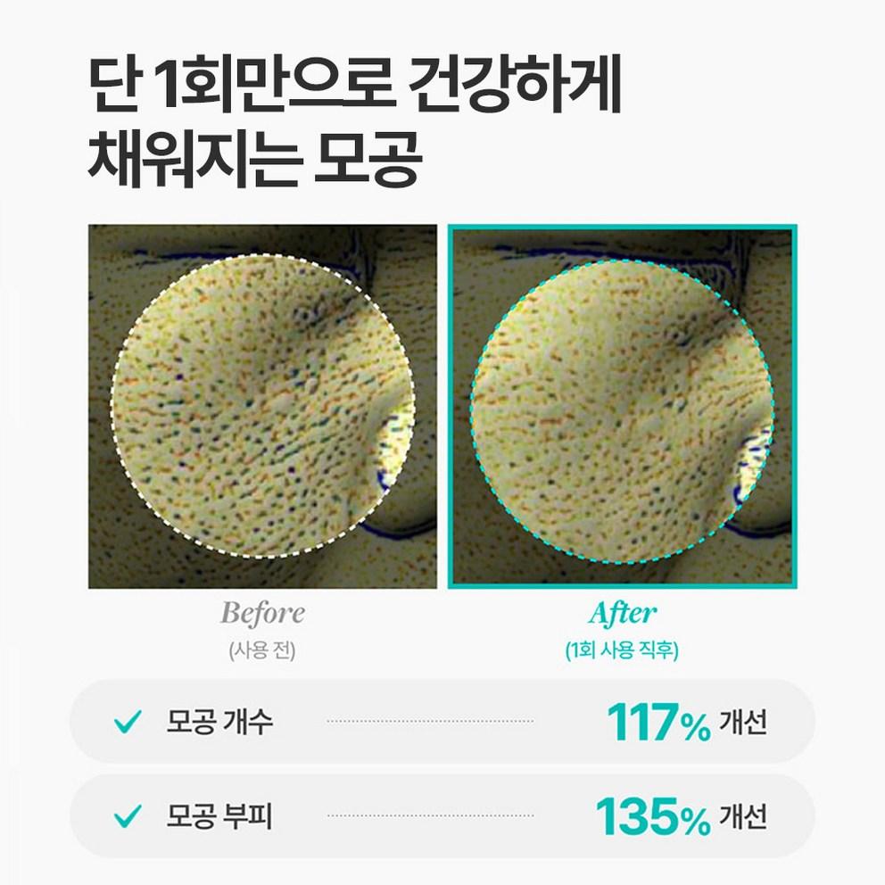 [Meditherapy] Poresera Real Bifida Blur Cream 50 мл