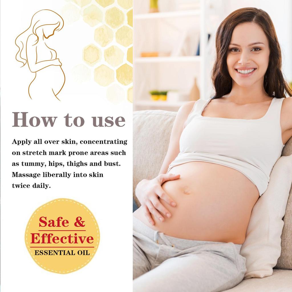 Anti-Stretch Mark Essential Oil-Provide Comfort And Relief To Stretched Skin-Keep Skin Soft And Supple, 30ml