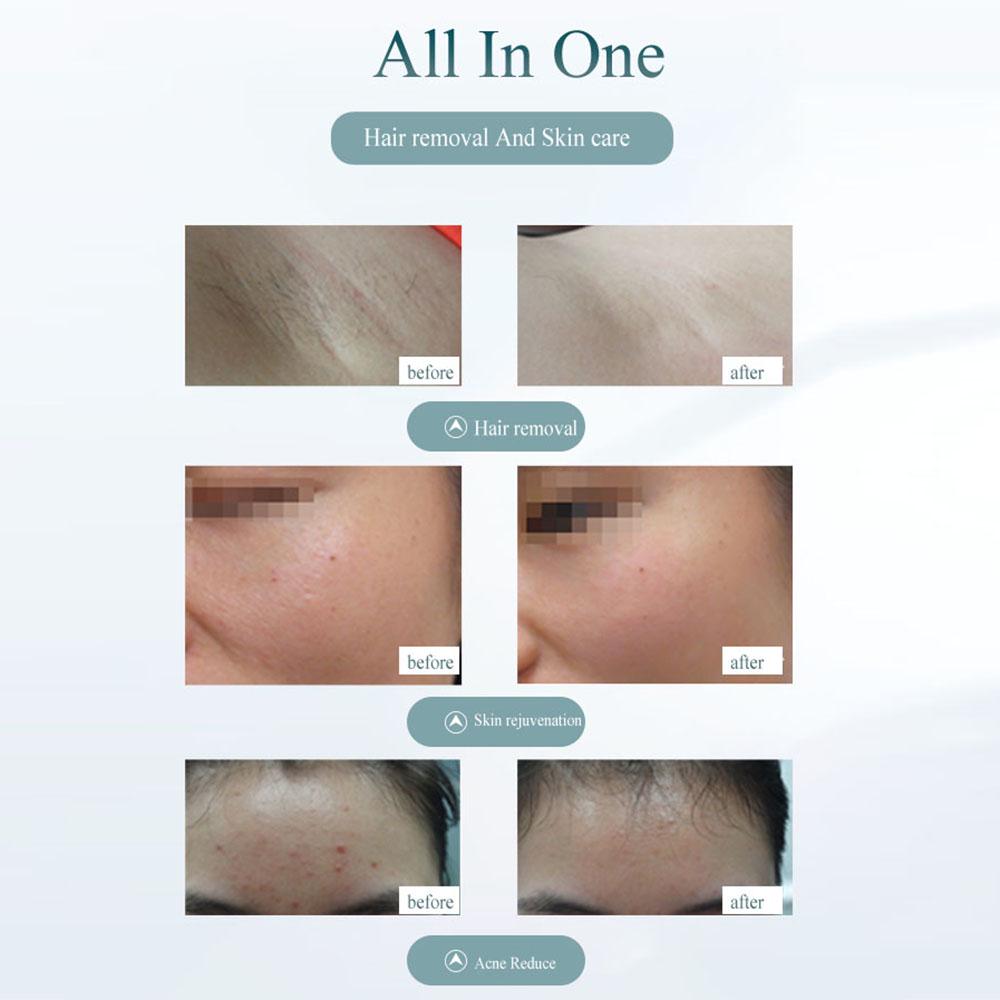 Инструмент для удаления волос Бритва Эпилятор Удалитель волос 900 000 вспышек Перманентный Безболезненный KTY