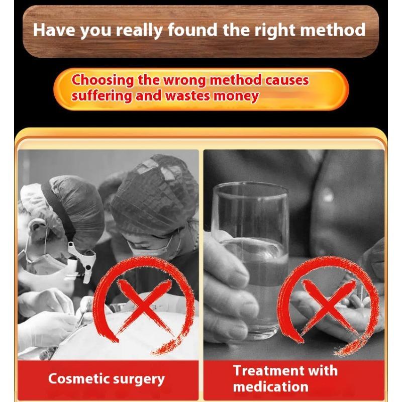 Whitening and Freckle Removing Cream Face Cream Lightening and Removing Spotles Sunburn Brightening Skin Color