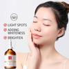 100ml Whitening Spot Serum Remove Freckles Chloasma Care Hyperpigmentation Spots Age Spots Dark P5B7