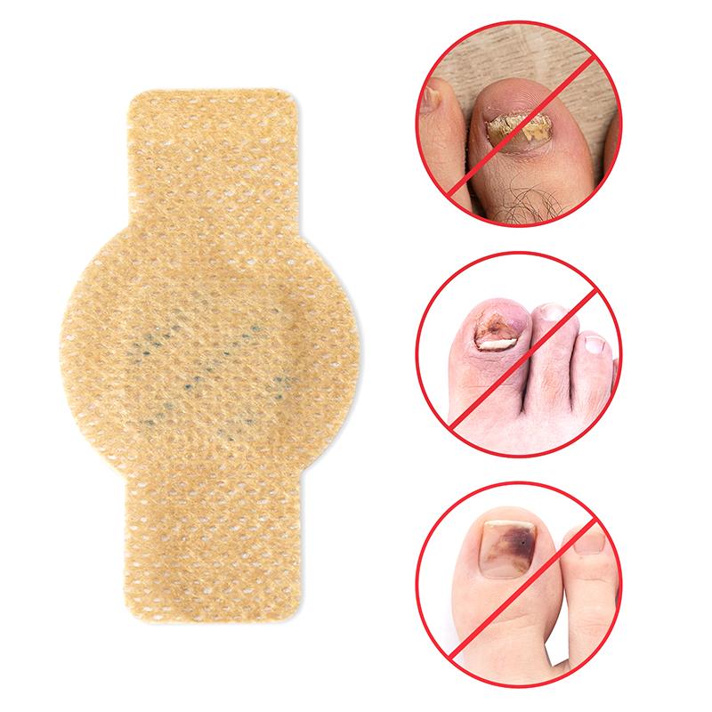 21 шт. Пластырь от грибка ногтей Водонепроницаемый пластырь для восстановления ногтей Наклейка для коррекции вросшего ногтя Пластыри для ухода за обесцвеченными поврежденными ногтями