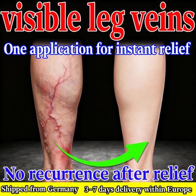 Паста для облегчения симптомов сосудистых звездочек – Улучшает кровообращение, Снимает усталость и тяжесть в ногах, Укрепляет капилляры, Быстродействующий эффективный пластырь