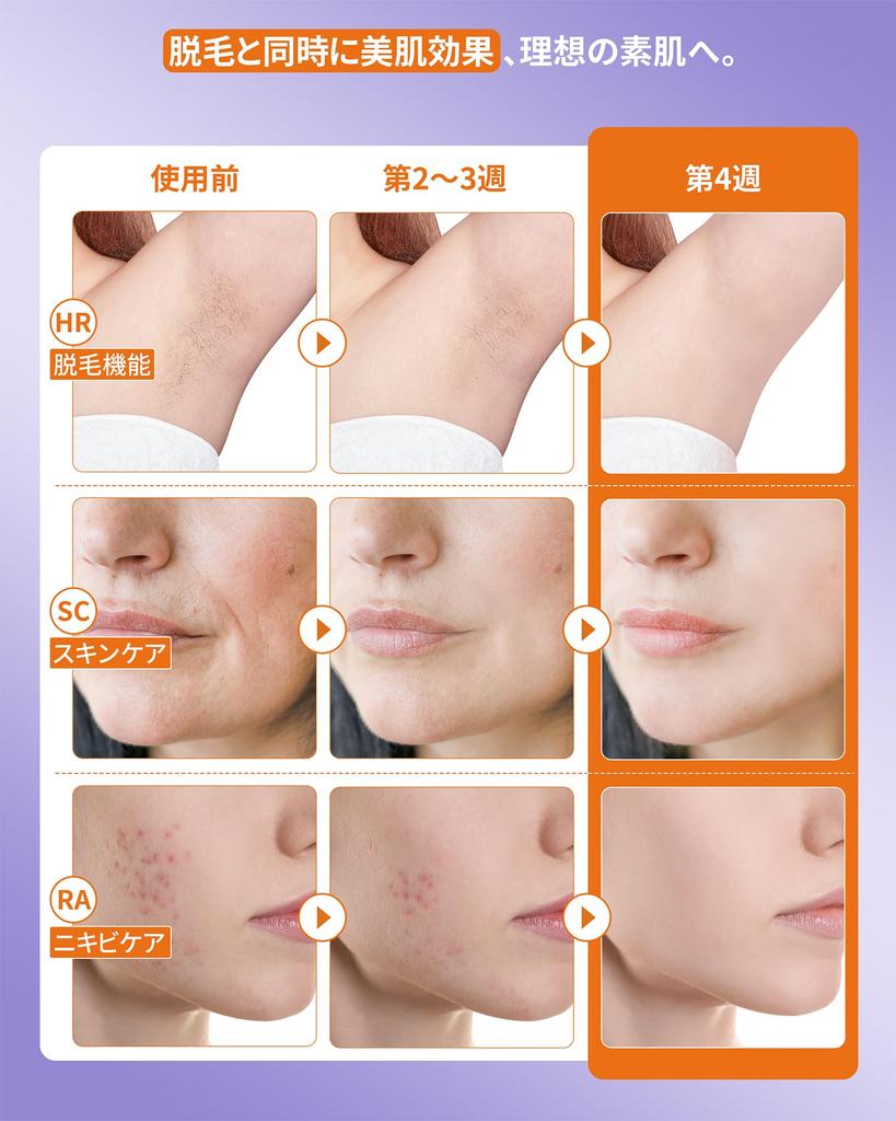 YUNDOO Sapphire Hair Removal Device for Women Compatible with VIO Most Advanced Salon Grade IPL Sapphire Hair Removal 9 High 3 In 1 Light Hair Removal