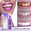 V34 Teeth Whitening Mousse – Stain Remover & Breath Freshener