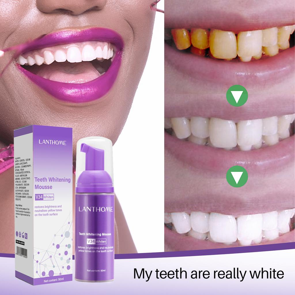 V34 Teeth Whitening Mousse – Stain Remover & Breath Freshener