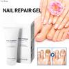 Гель для ухода за ногтями рук и ног, онихомикоз, размягчение ногтей, утолщение ногтей, люминесцентный гель для восстановления ногтей