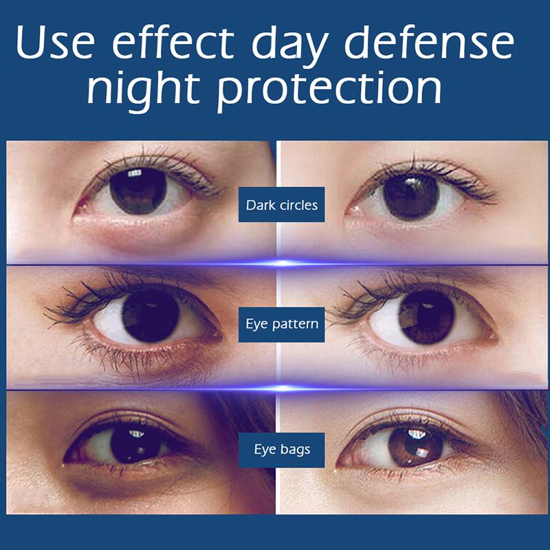 SENANA Крем для глаз Caviar Repair Увлажняющий лифтинг Укрепляющий успокаивающий уход за глазами