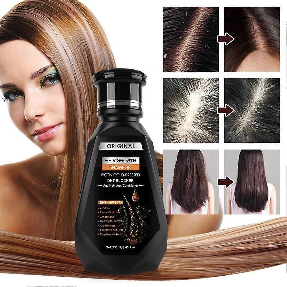 Ginger Shampoo Hair Treatments Hair Growth Hair Care Anti-hair Loss Hair