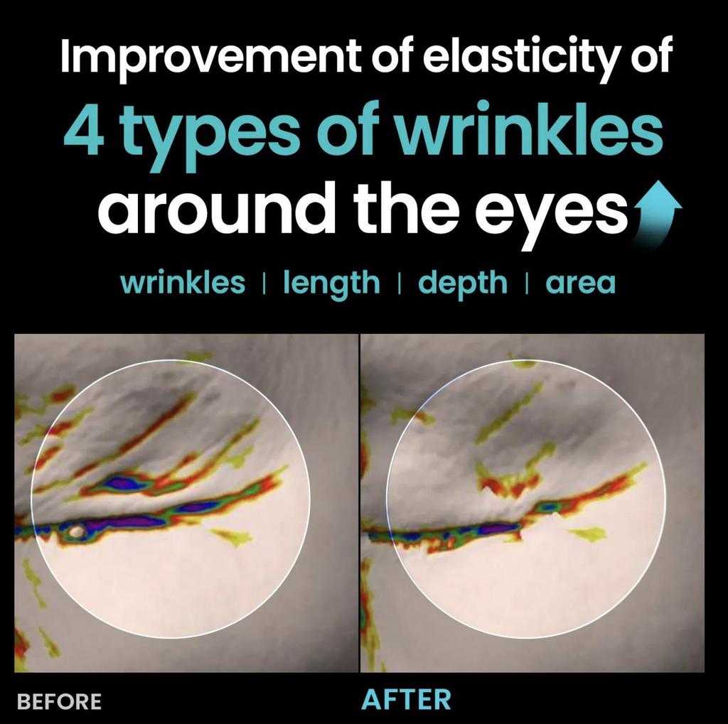 ilso ER Elastoin Retinol Adenosine Serum – Advanced Anti-Aging & Firming Serum (30ml)