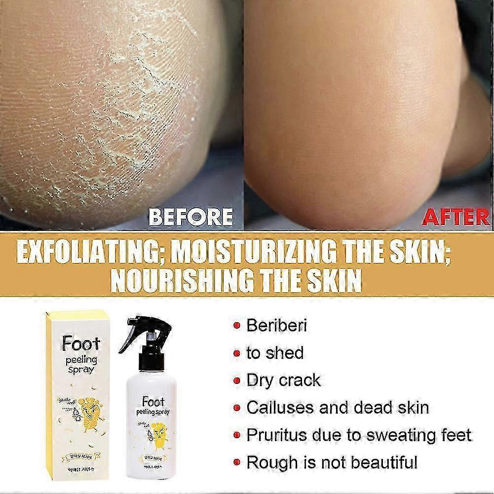 Foot Exfoliation Repair & Brightening Spray Remove Dead Skin Calluses Foot Rejuvenation Treatment 26s