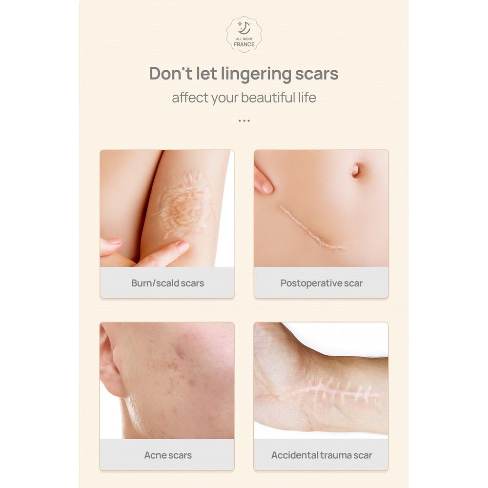 LANBENA Крем для удаления шрамов, акне, растяжек, увлажняющий крем для ухода за кожей, 40 г