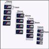 16/17/19mm Car Steering Wheel Decor Stickers Center Hub Cap Emblem DIY Decal Ornament Accessories For BMW M Performance X3 X5 X7