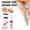 Vein Varicose Veins Spray, Vein Varicose Veins Spray, Vein Varicose Veins Spray 30ml