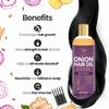 TNW-The Natural Wash Onion Hair Oil for Strong & Healthy Hair With Black Seed Oil Extracts | Onion Oil Prevents Hair Fall 100 Ml