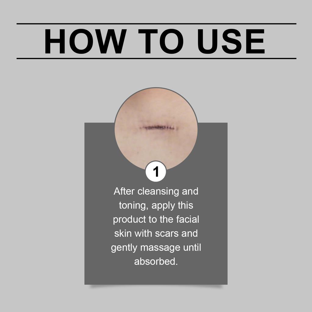 Skin Scar Moisturizing Care Stick: Smooths the Appearance of Skin Scars. Daily Care Cream