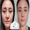 Увлажняющий крем нежный и не раздражающий, укрепляет кожу, улучшает цвет лица, уменьшает недостатки, увлажняет и питает кожу.