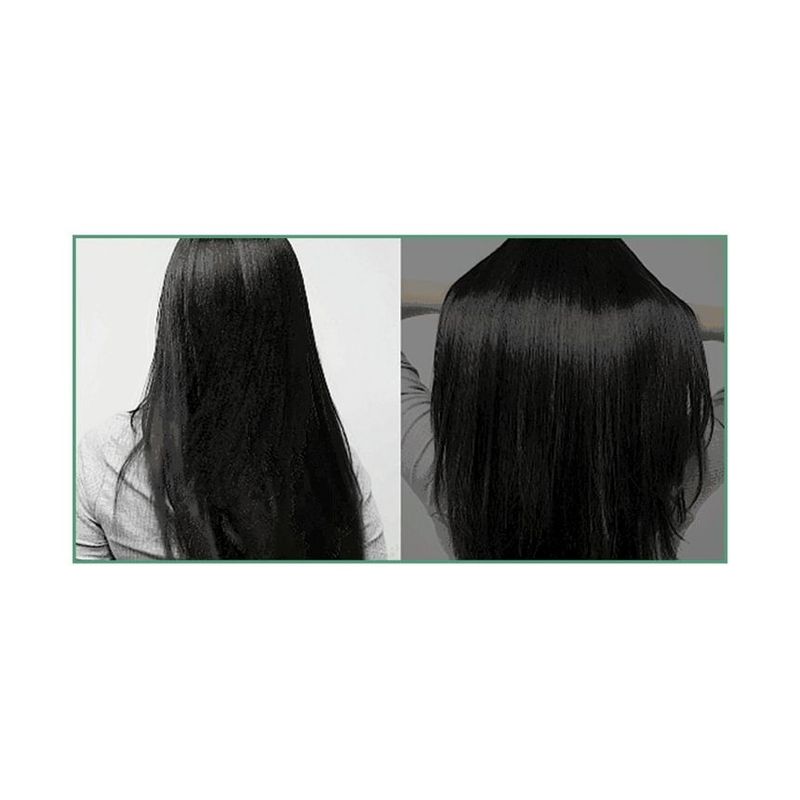DR.FORHAIR Фитотерапевтическое лечение Jumbo