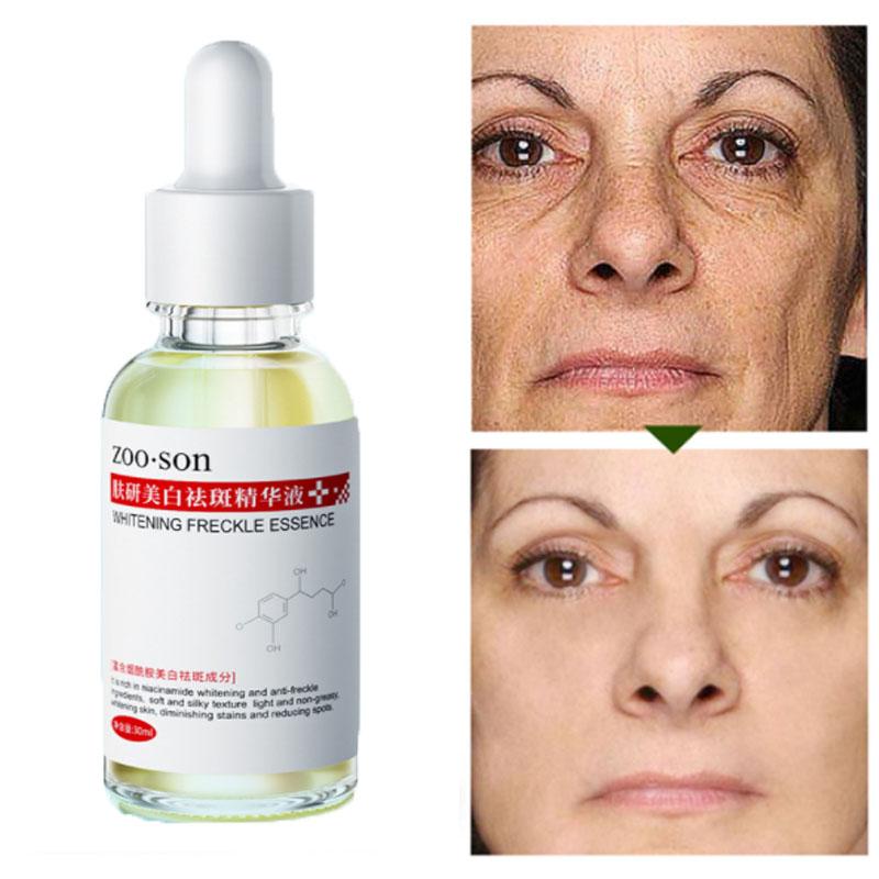 Отбеливающая эссенция против веснушек, увлажняющая, сужающая поры, осветляющая тон кожи и контролирующая жирность сыворотки для лица
