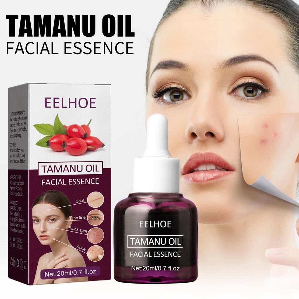 EELHOE Масло для лица «Бегония» уменьшает следы от прыщей, осветляет морщины, увлажняет и укрепляет кожу. Эфирное масло