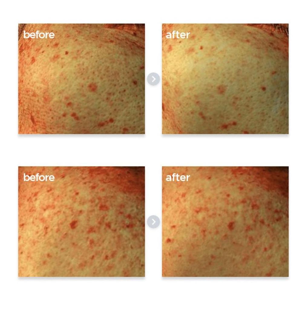 Make P:REM Poncirus Trifoliata C Сыворотка от темных пятен 40 мл
