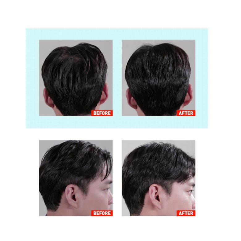 Grafen Remover Shampoo 500ml