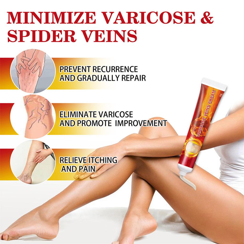 2pcs Health Cream For Relieving Varicose Veins, External Ointment For Vasculitis, Blood Circulation, Varicose Veins