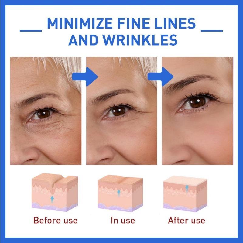 Collagen Anti-wrinkle Essence Reduces Facial Fine Lines and Wrinkles, Tightens Nasolabial Folds and Prevents Aging