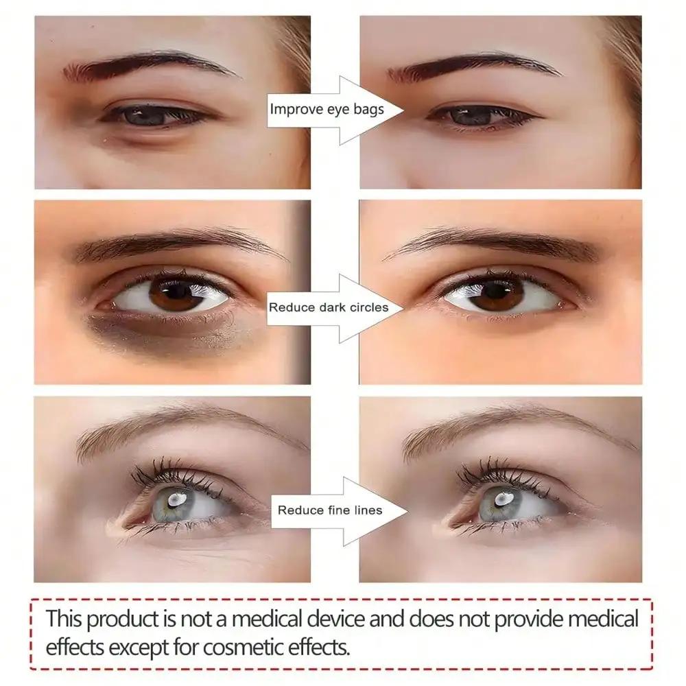 3D EMS Инструмент для красоты глаз Микротоковый импульсный релаксатор для глаз Уменьшает морщины и темные круги Устраняет мешки под глазами Массажер Инструмент для красоты