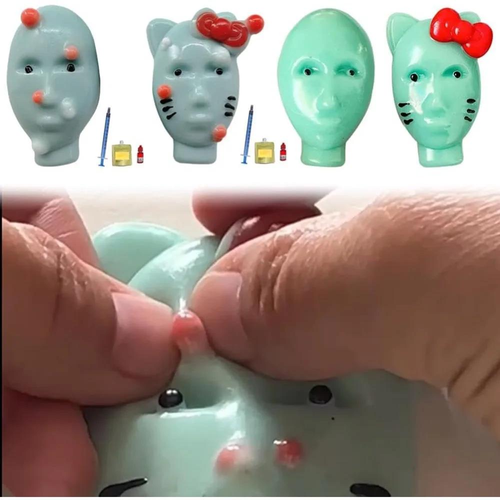 Funny Pimple Popper Toy Weird Pimple Popping Toy with Acne Filler Tools Novelty Stress Relief Pimple Popper