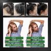 Hair Growth Product, Rosemary Growing Hair Essential Oil Beauty Hair Care, Prevent Hair Loss