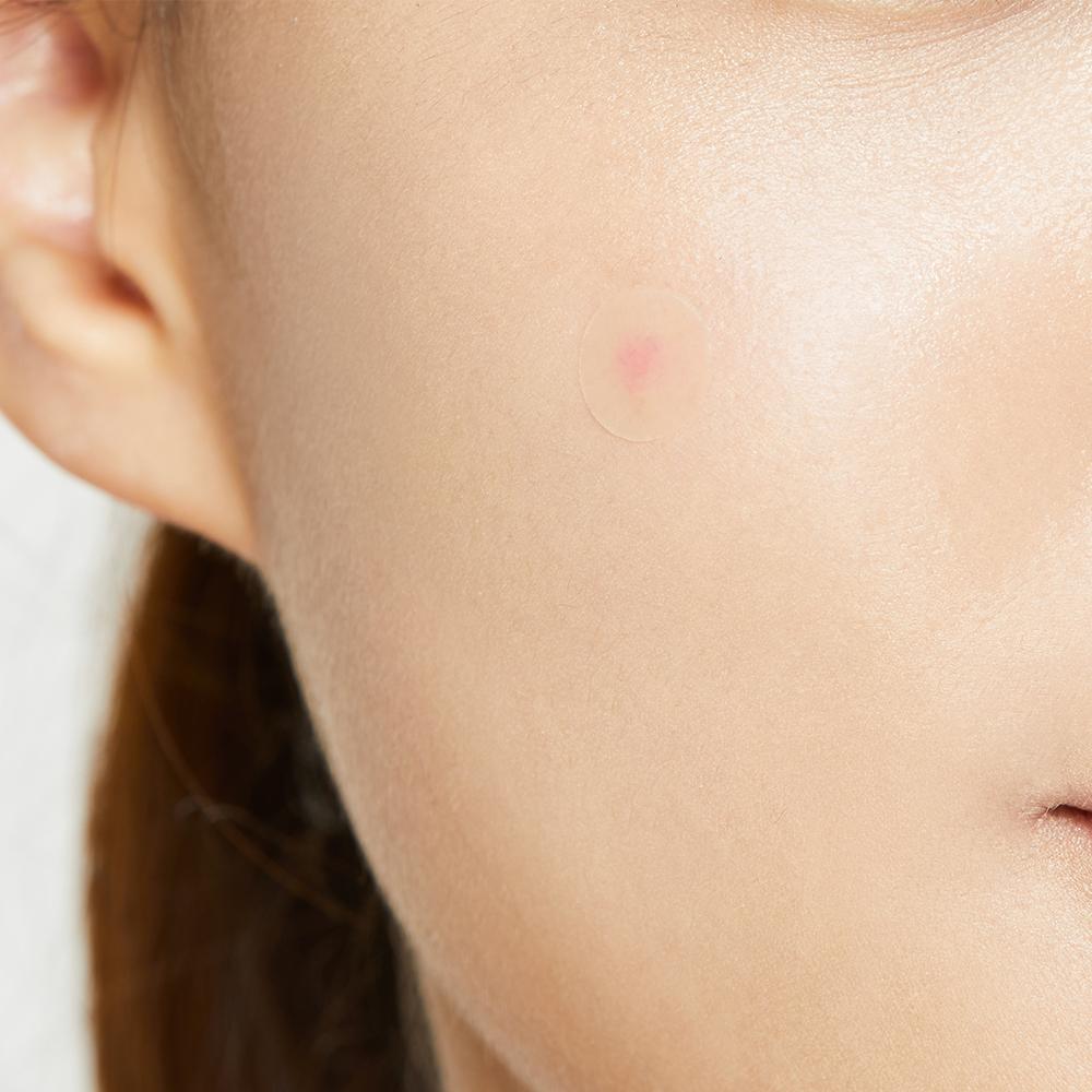 COSRX Acne Pimple Master Patch (3 варианта)