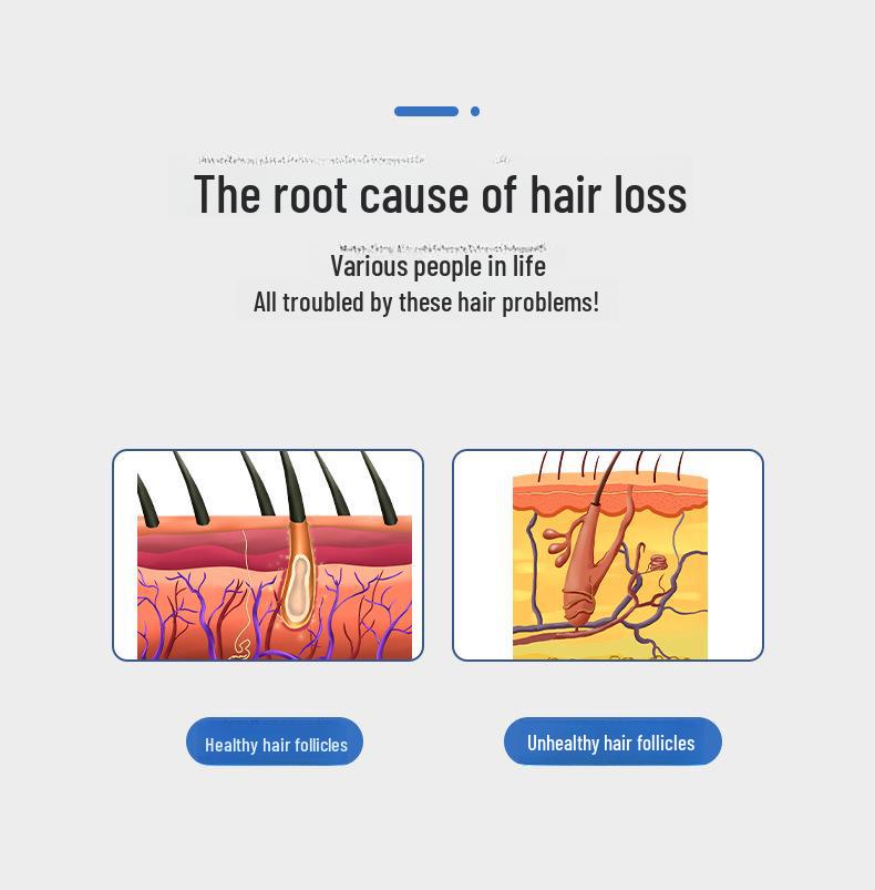Электрический массажер для кожи головы против выпадения волос со светотерапией