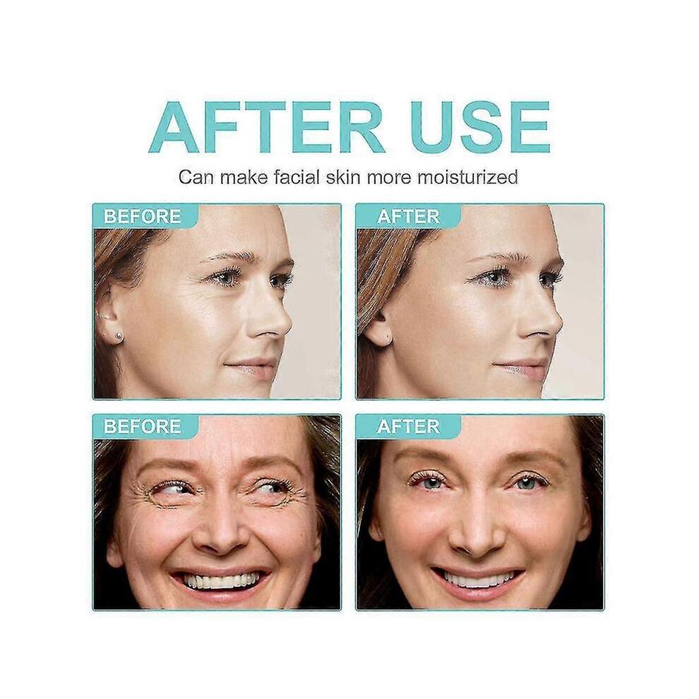 Retinol Moisturizer, Face Moisturizer Retinol Cream with 2.5% Retinol and Hyaluronic Acid, Anti-Aging Anti-Wrinkle Retinol Cream