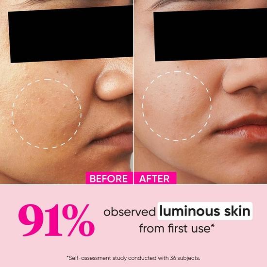 Dot & Key Watermelon 10% гликолевая сыворотка для сияния лица с койевой кислотой | Борется с пигментацией и темными пятнами | Борется с тусклостью, неровной текстурой | 30 мл