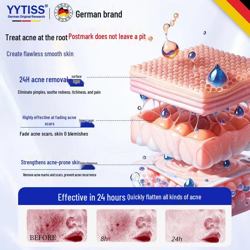 YYTISS Крем для лечения акне