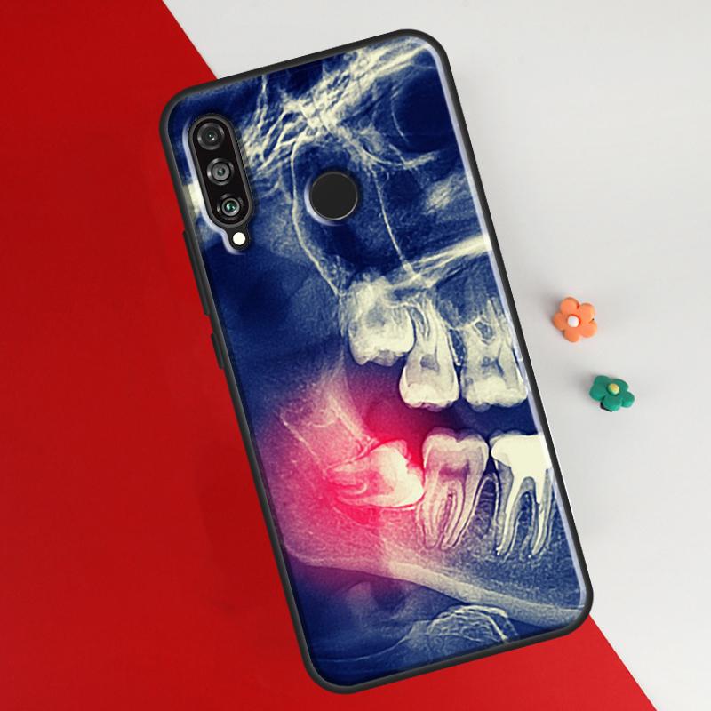 Чехол с рисунком зуба стоматолога для Huawei P30 Pro P50 P20 P40 Lite P Smart 2021 Nova 5T, чехол для Honor 50 8X 10i