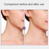 Neck Lifting Patch Invisible High Elastic Instant Neck Lift Bands for Double Chin Jowls Waterproof Neck Wrinkle Reducer