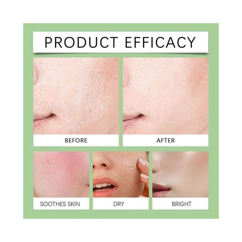 Anua Azelaic Acid 10 Hyaluron Redness Soothing Serum, Facial Serum for Sensitive Skin, Hyaluronic Acid, Niacinamide, Spot Care less