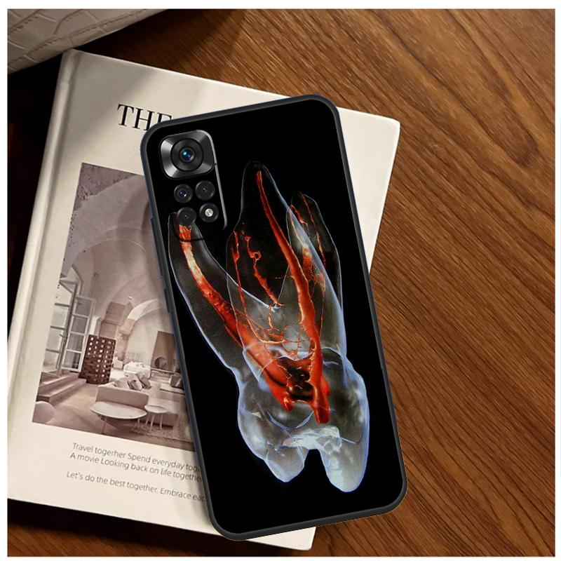 Чехол-анатомия человеческого зуба для Xiaomi Redmi Note 13 11 10 9 8 12 Pro Plus 12S 11S 10S 9S 10A 9C 10C 12C 13C Funda
