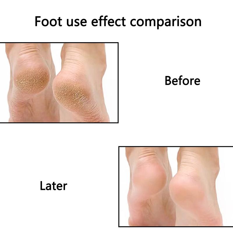 15/20/25 мм Удаление кутикулы на ногах, мозолей, Сменная наждачная бумага с дисками для педикюра, Набор подушечек, Очиститель мертвой кожи, Пилки для ног