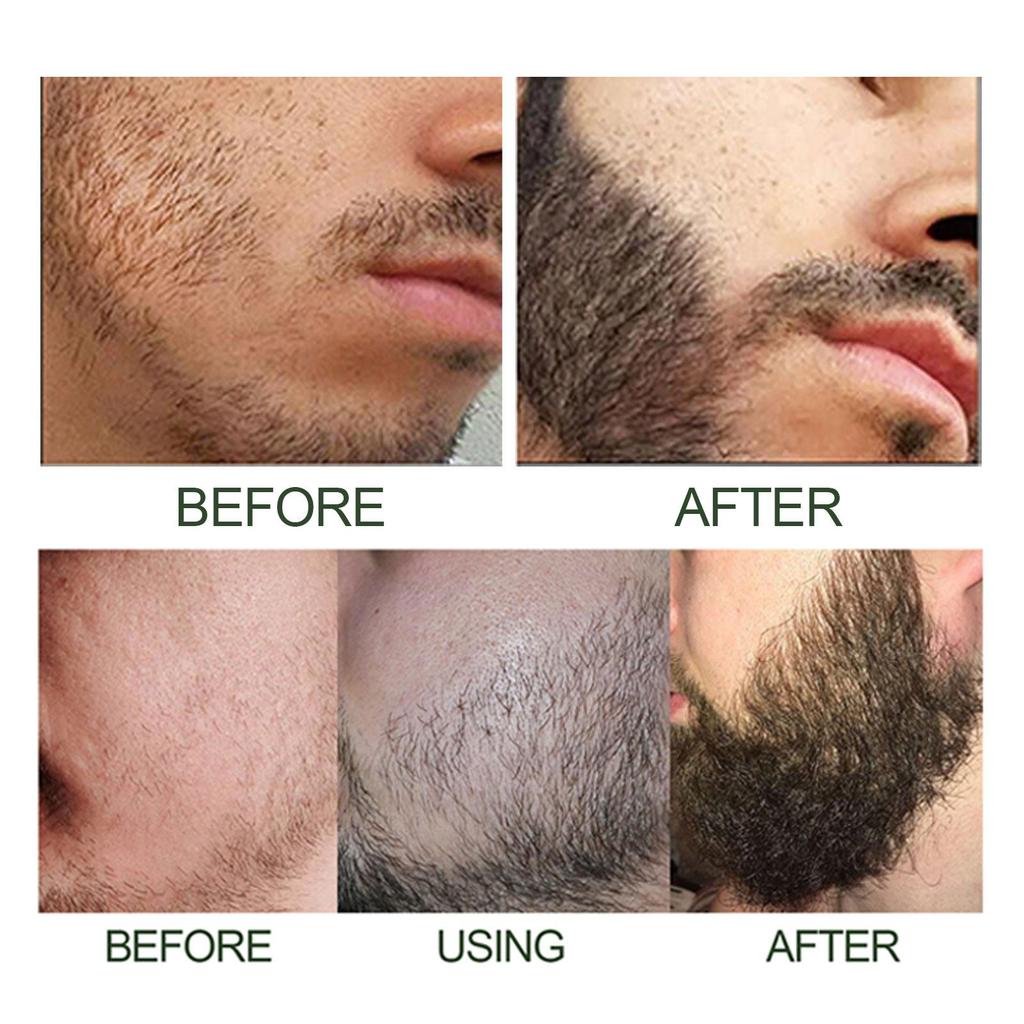 Beard Care Kit, deeply moisturizes and nourishes the beard, promotes a fuller beard, enhances masculine charm.