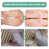 South Moon Odor-eliminating Foot Spray Refreshes And Moisturizes 45ml Boxed