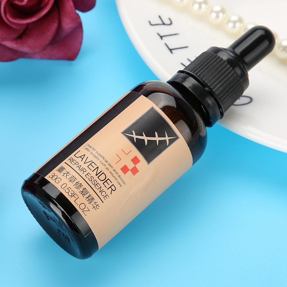 Эссенция для лечения угревой сыпи и рубцов Lavender Scar Acne Repair Essence Essence Stretch Marks Treatment Skin Repair Liquid